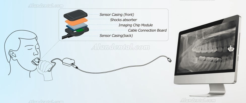 Digital Dental Image Sensor USB Working with X-ray Equipment + 500 Sheaths